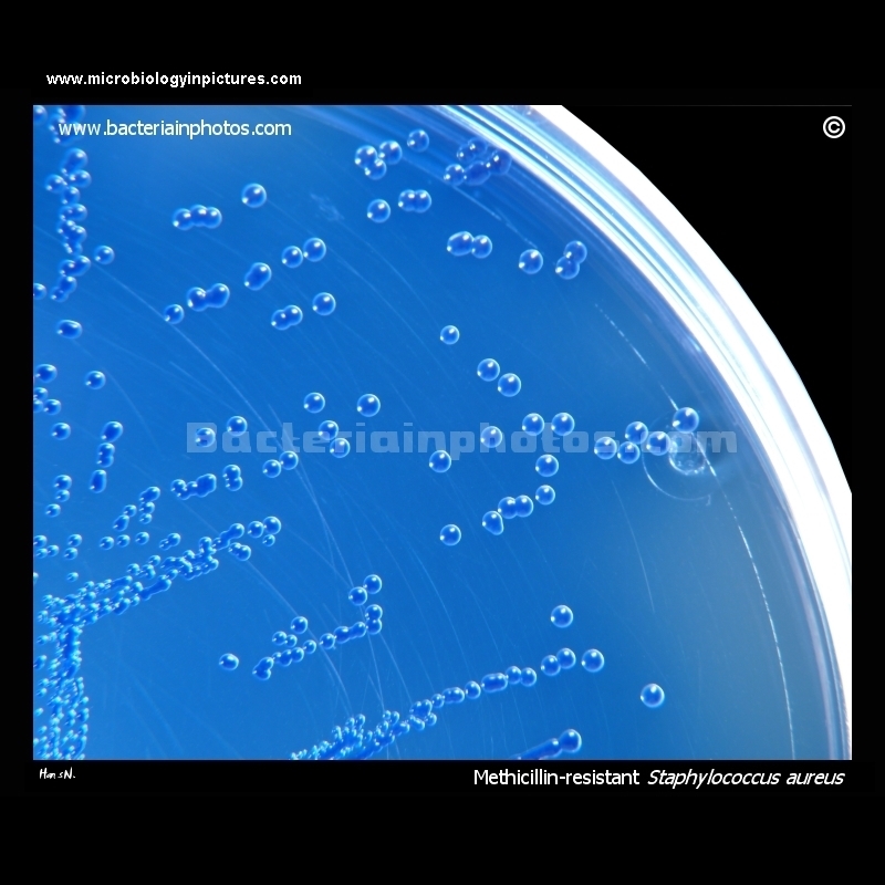 MRSA on ORSAB