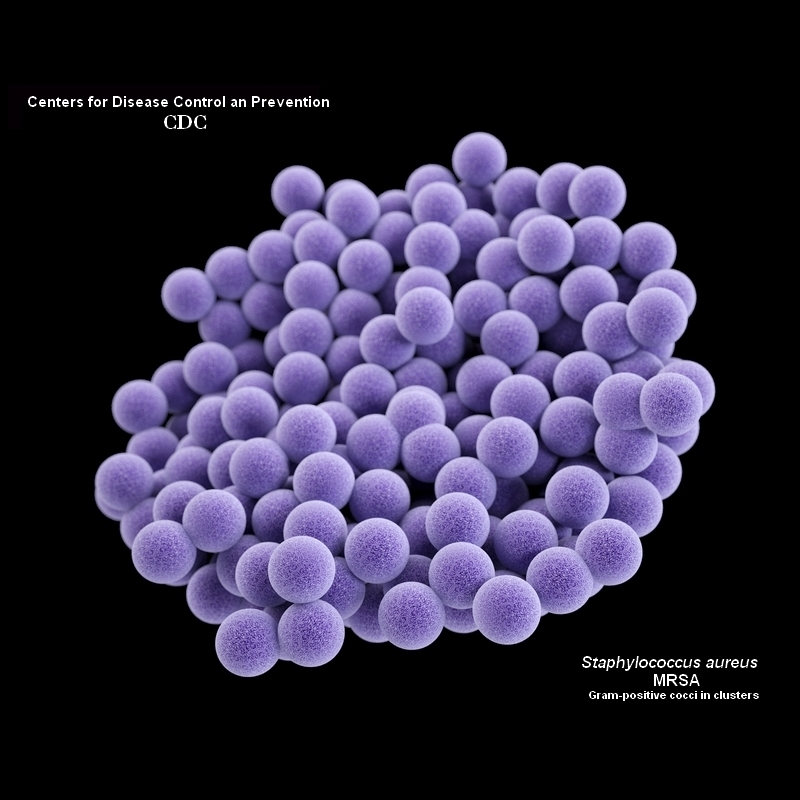 MRSA image