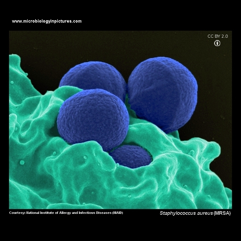 MRSA image (electron microscopy)