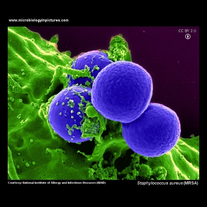MRSA electron microscopy (SEM)