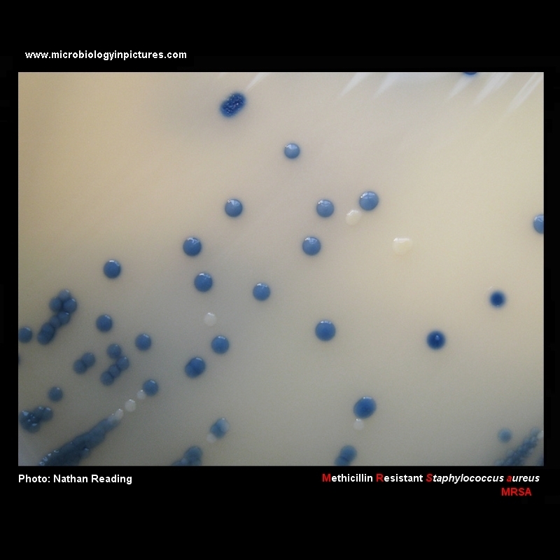 MRSA Staphylococcus aureus colonies on Brilliance MRSA Chromogenic agar