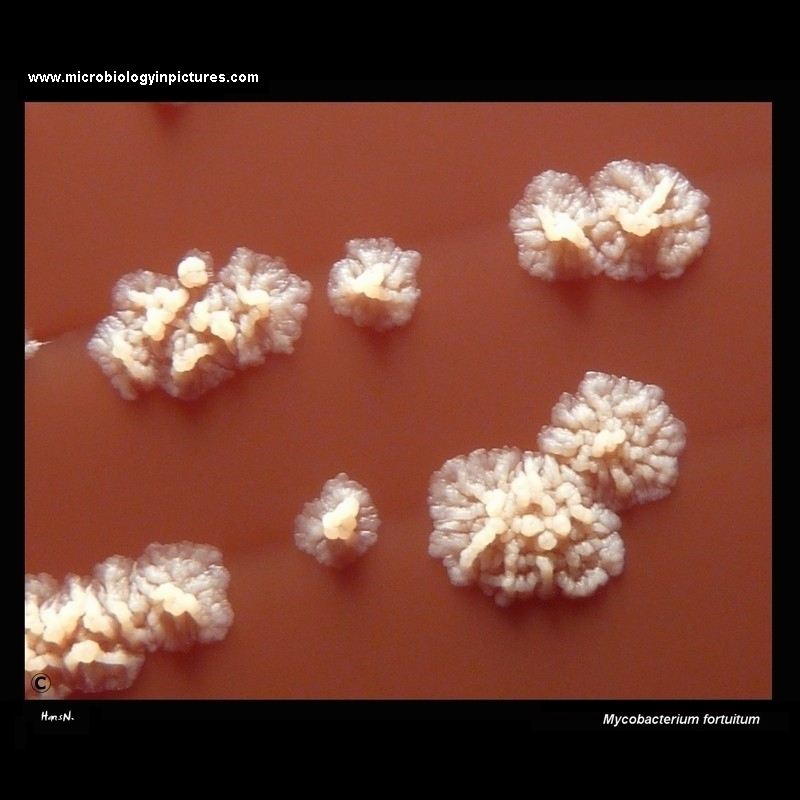 Mycobacterium fortuitum colonies on blood agar 