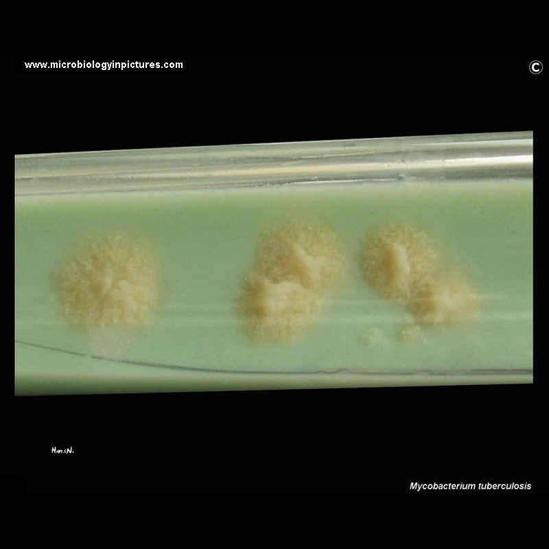 Mycobacterium tuberculosis colonies on L�wenstein-Jensen medium 