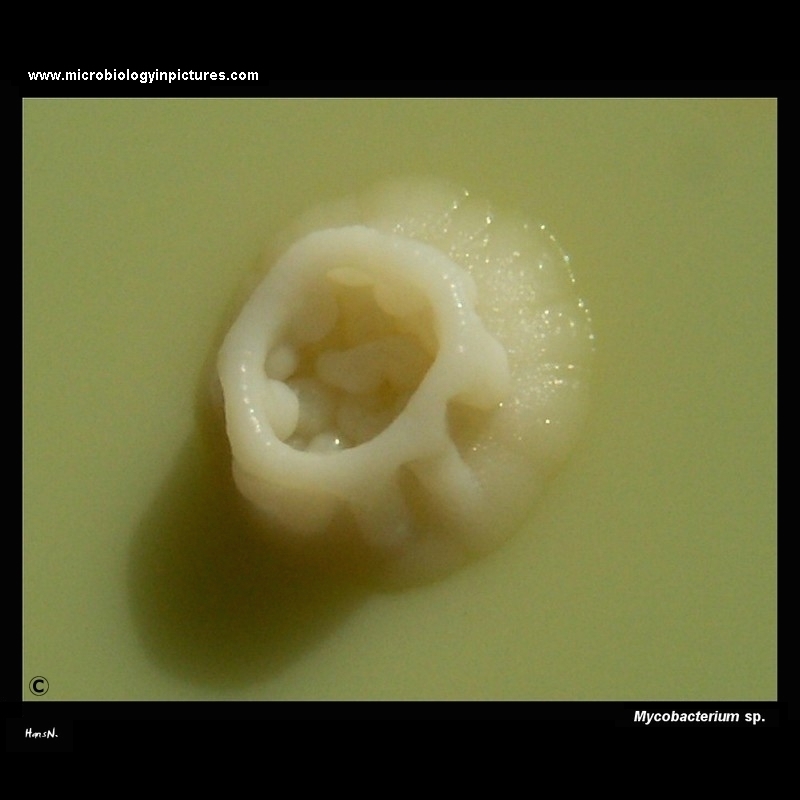 Mycobacterium sp. colony on Ogawa medium