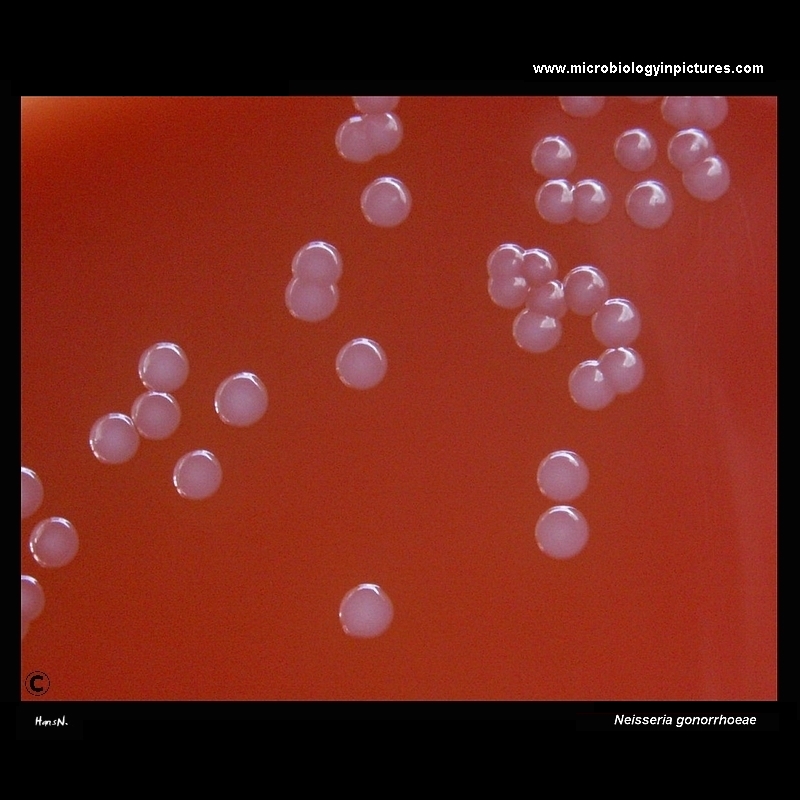 Neisseria gonorrhoeae colonies