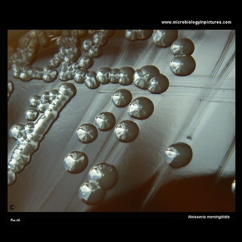 Neisseria meningitidis colonies on agar plate