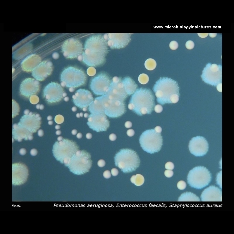 P.aeruginosa, E.faecalis, S.aureus on TSA