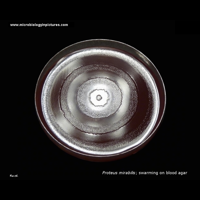 proteus mirabilis on blood agar