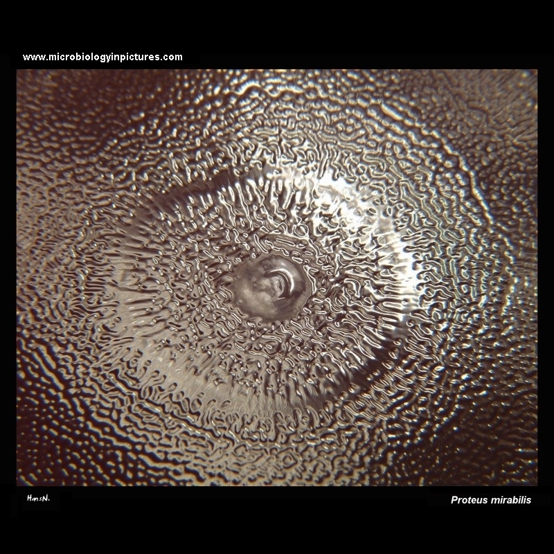 Proteus mirabilis on blood agar