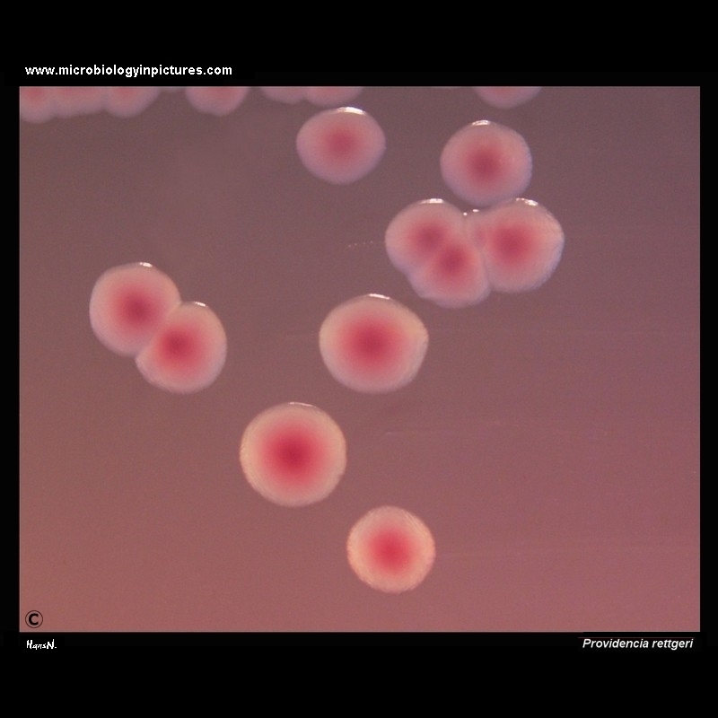 Providencia rettgeri colonies on Endo agar
