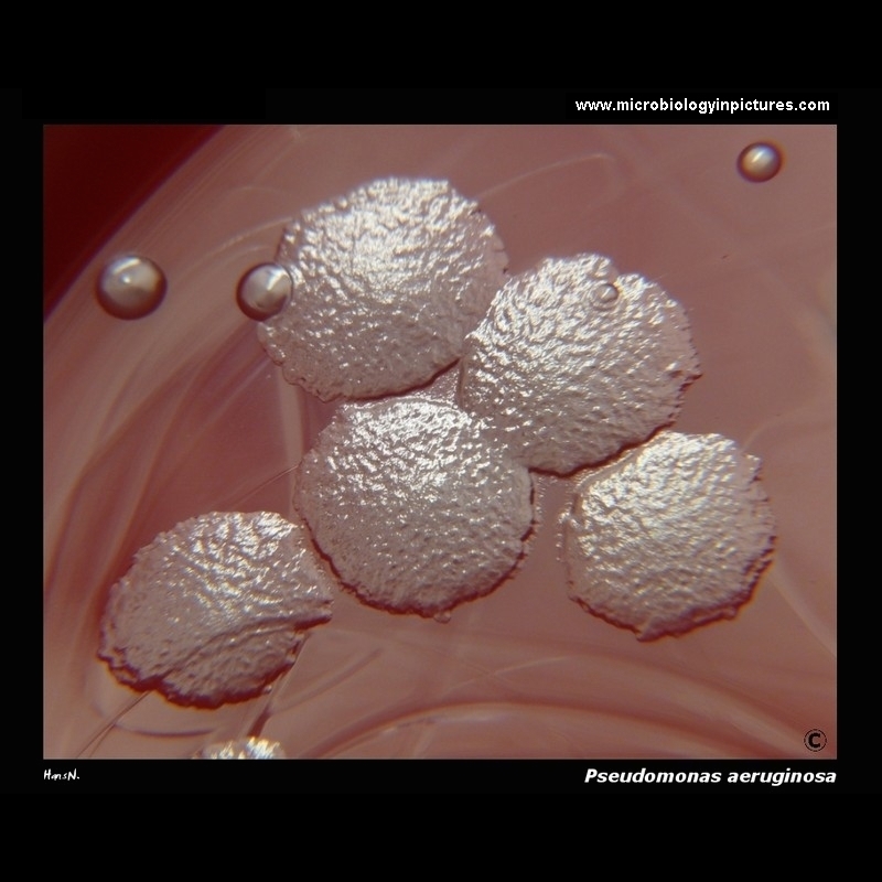 pseudomonas aeruginosa colonies on blood agar