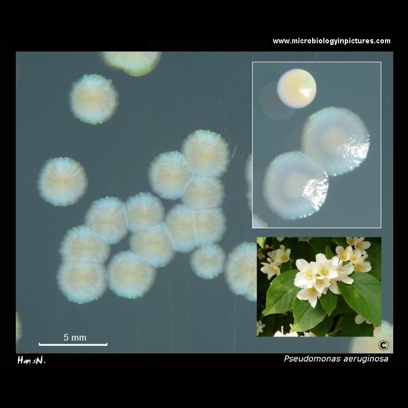 pseudomonas aeruginosa pigment