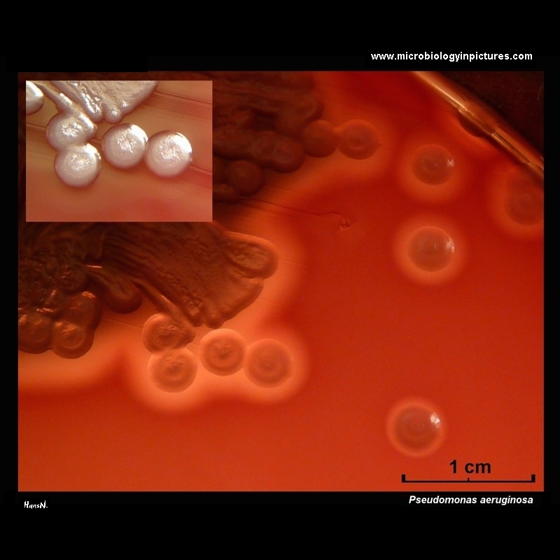 pseudomonas aeruginosa colonies on blood agar surrounded by a zone of beta-hemolysis