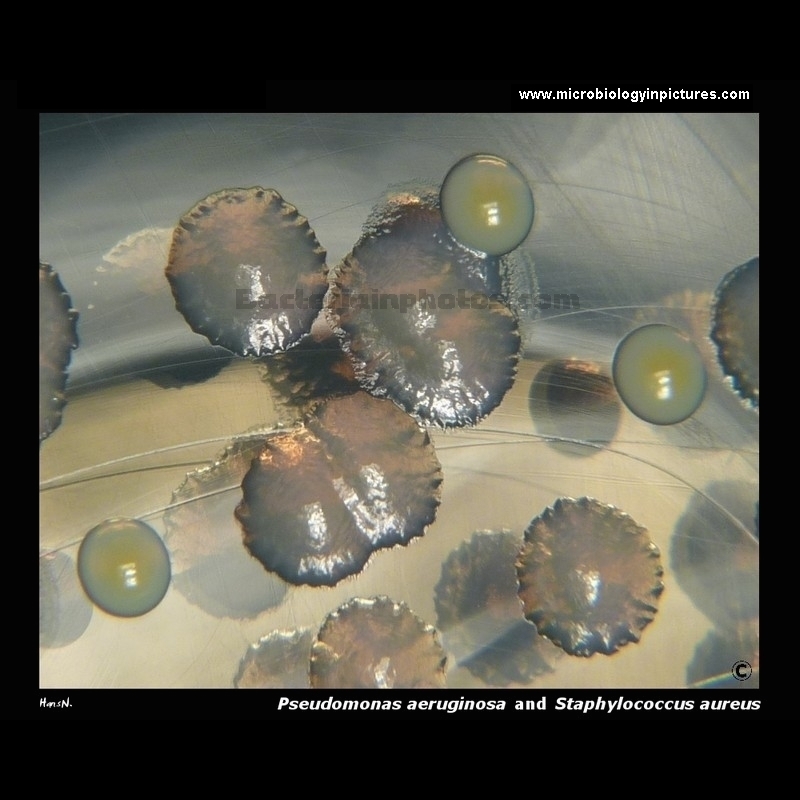 pseudomonas aeruginosa
