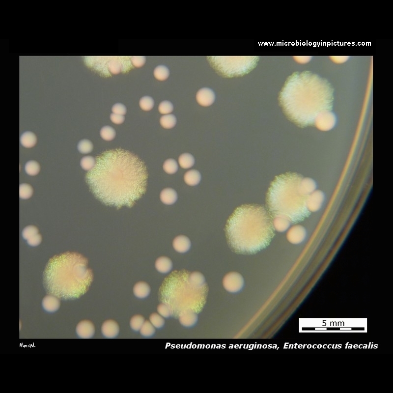 pseudomonas aeruginosa Tryptic Soy Agar