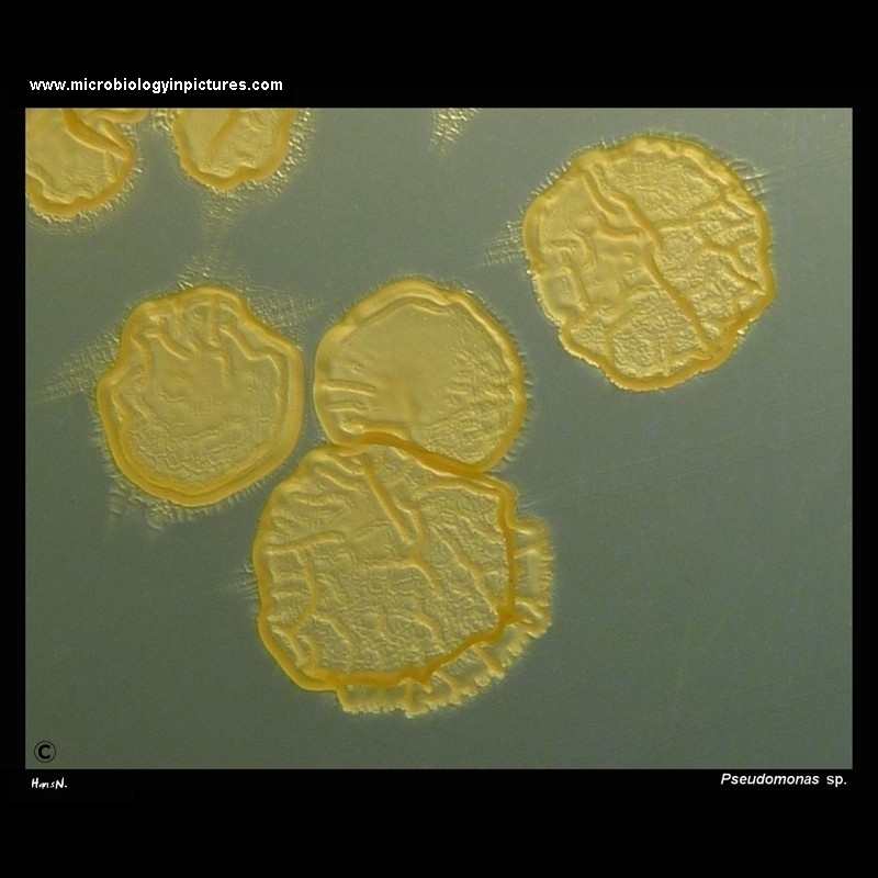 Peudomonas spp. colonies