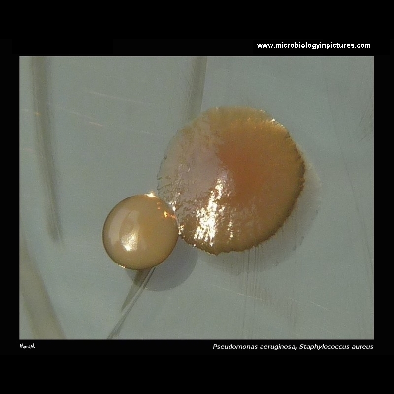 pseudomonas aeruginosa and staphylococcus on Tryptic Soy Agar