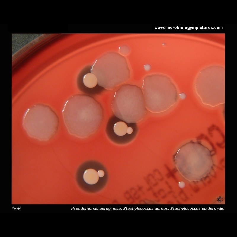 pseudomonas aeruginosa