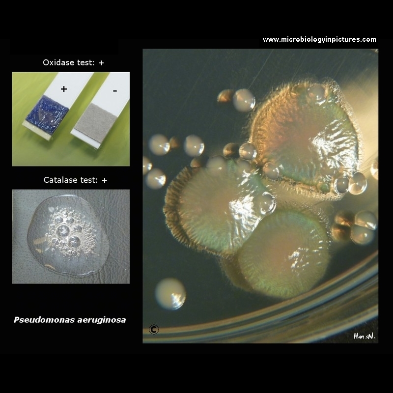 pseudomonas aeruginosa oxidase and catalase test