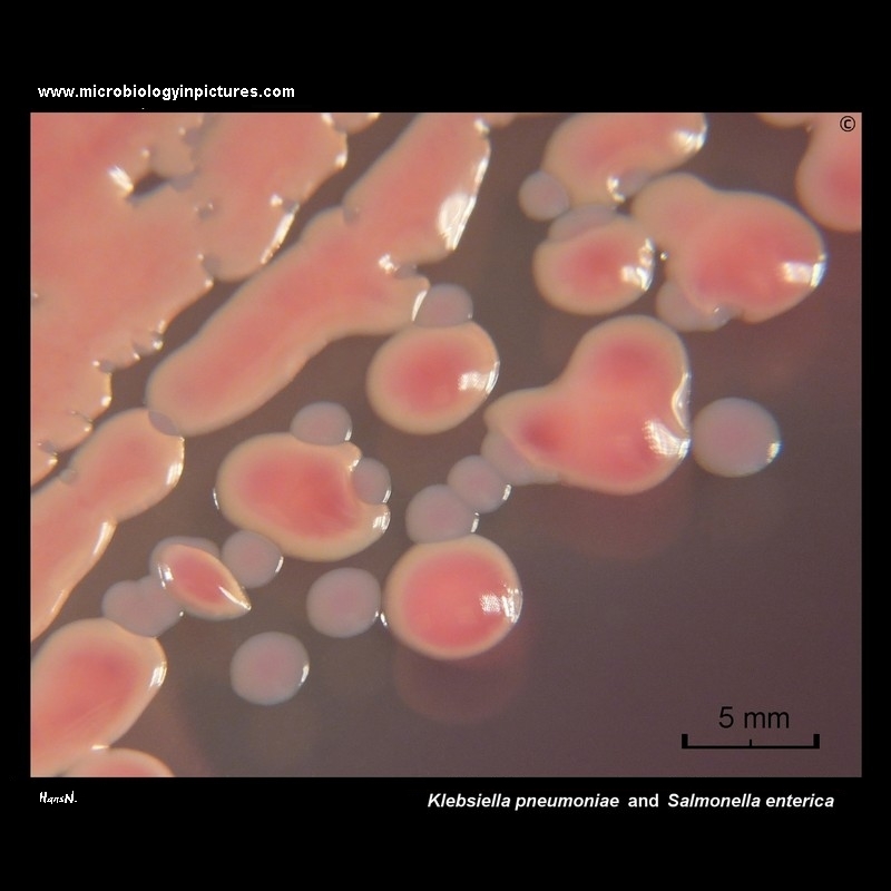salmonella and klebsiella enterica colonies on MacConkey agar