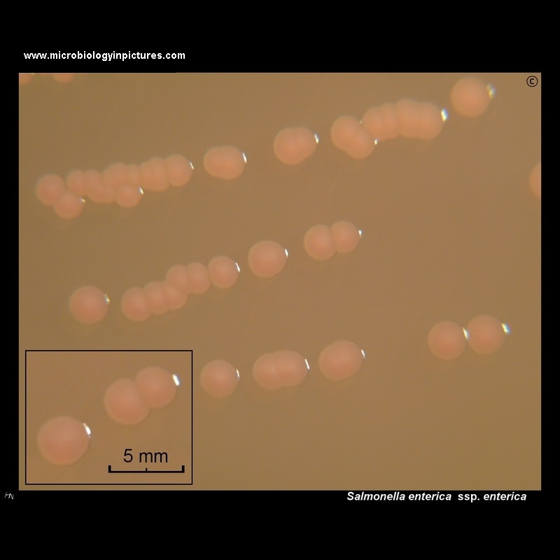 salmonella enterica colonies on MacConkey agar