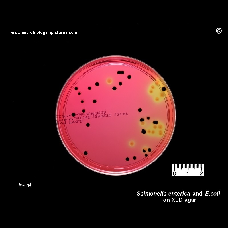 salmonella Enteritidis
