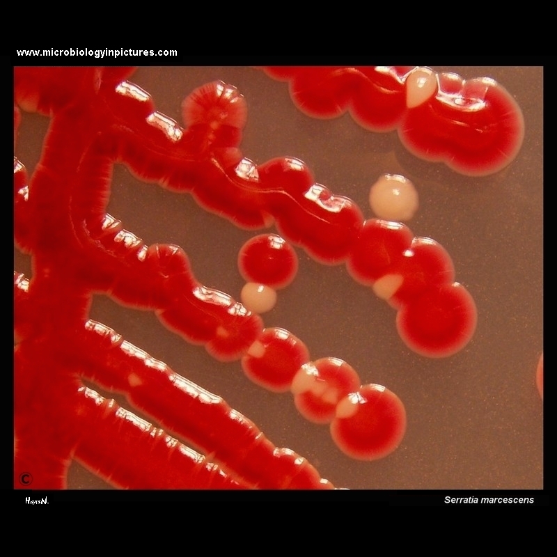 Serratia marcescens colonies