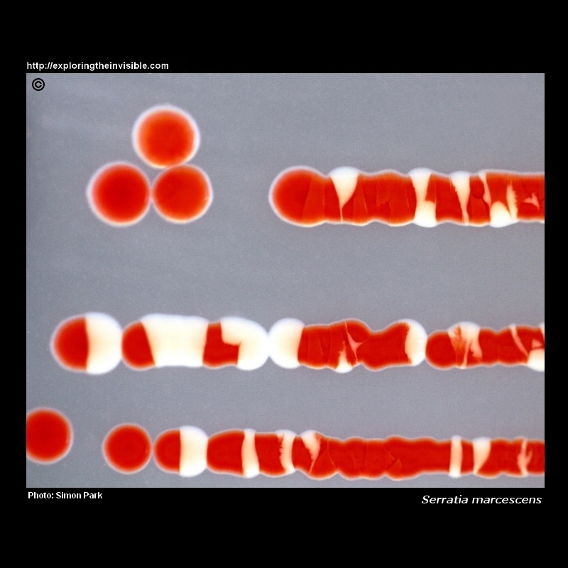 Serratia marcescens red pigmented colonies