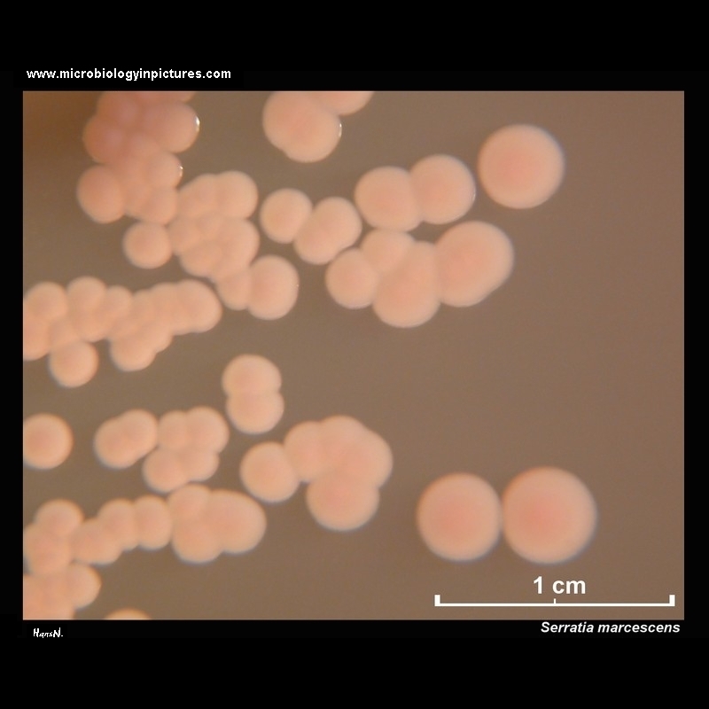 Serratia marcescens colonies on MacConkey agar