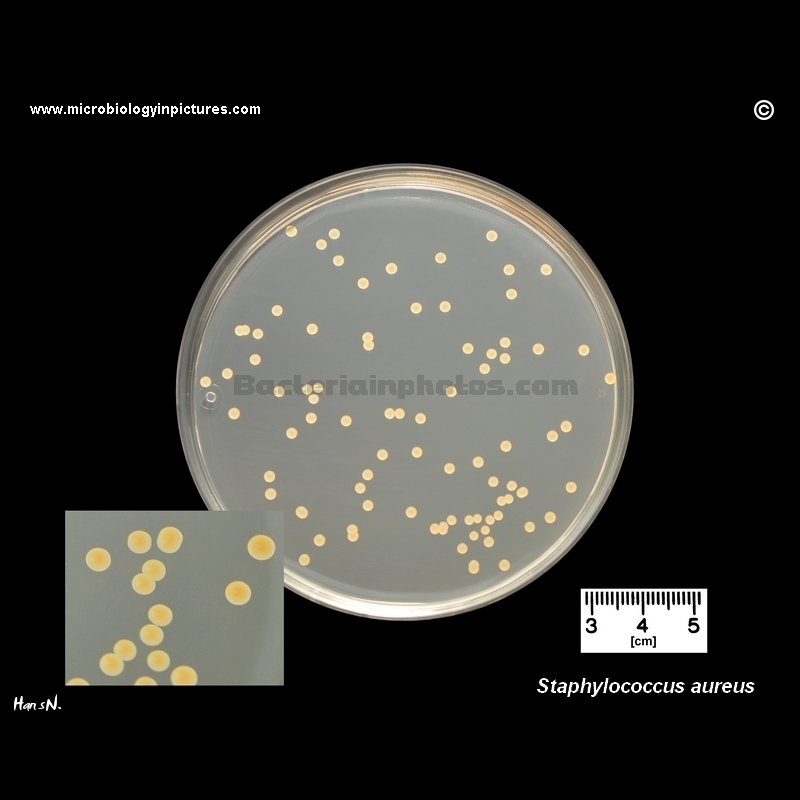 Growth of Staphylococcus aureus on tryptic soy agar