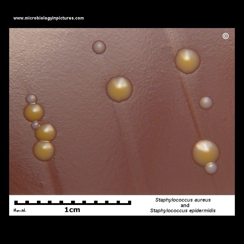 Staphylococcus aureus and Staphylococcus epidermidis