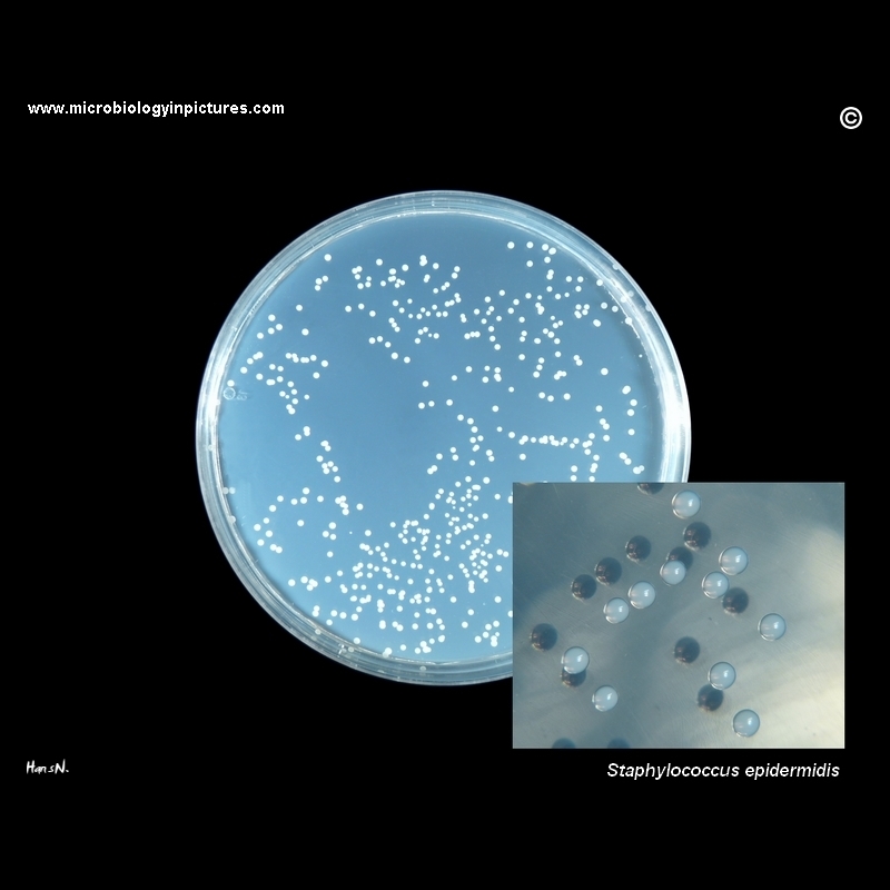staphylococcus epidermidis on Petri dish