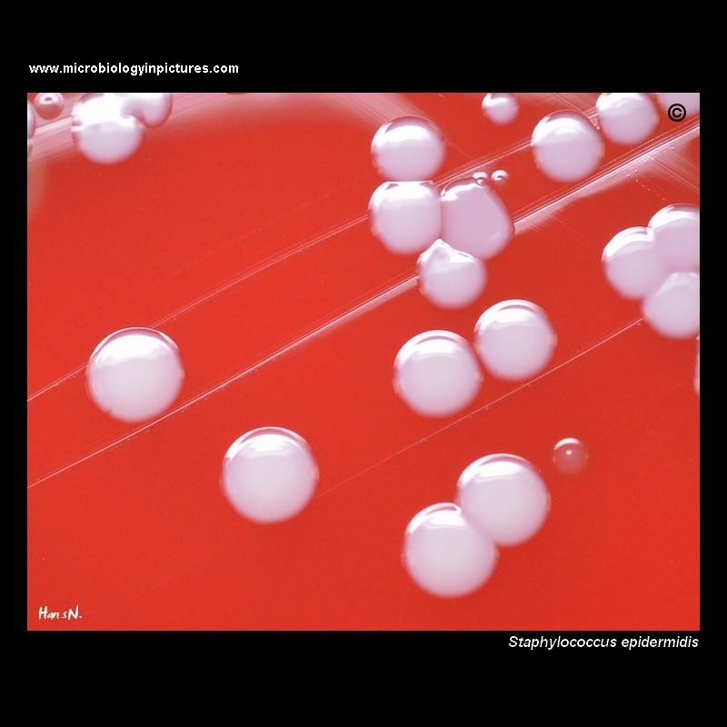 staphylococcus epidermidis on blood agar
