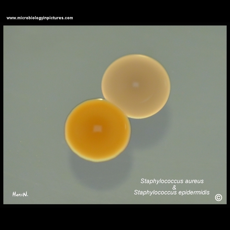 staphylococcus epidermidis and aureus on agar