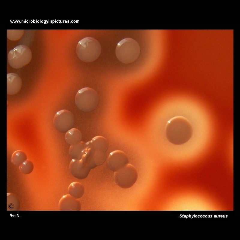 Staphylococcus aureus colonies on blood agar, beta-hemolysis