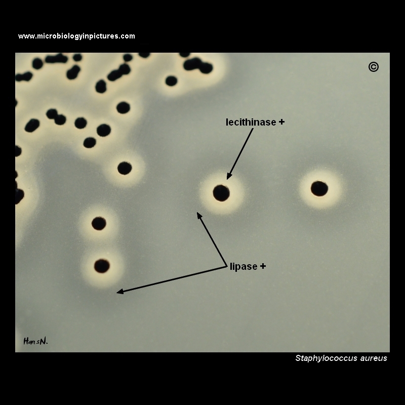 colonies of S.aureus on baird parker agar.jpg