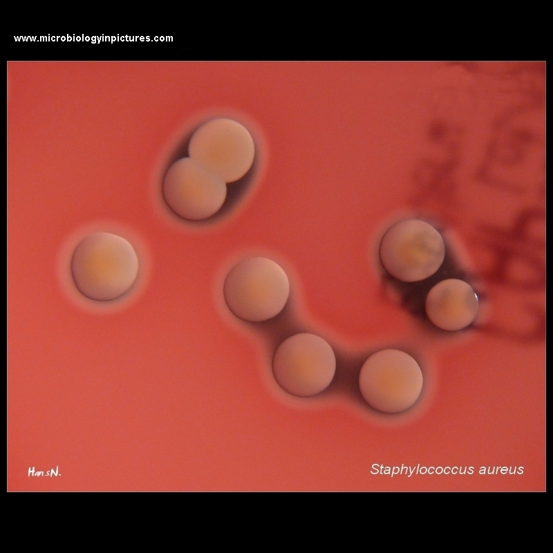 S.aureus colonies on blood agar, beta-hemolysis