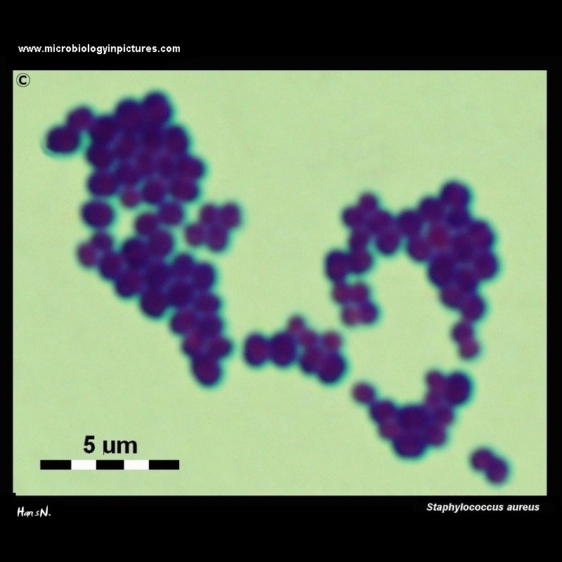 Staphylococcus aureus light microscopy