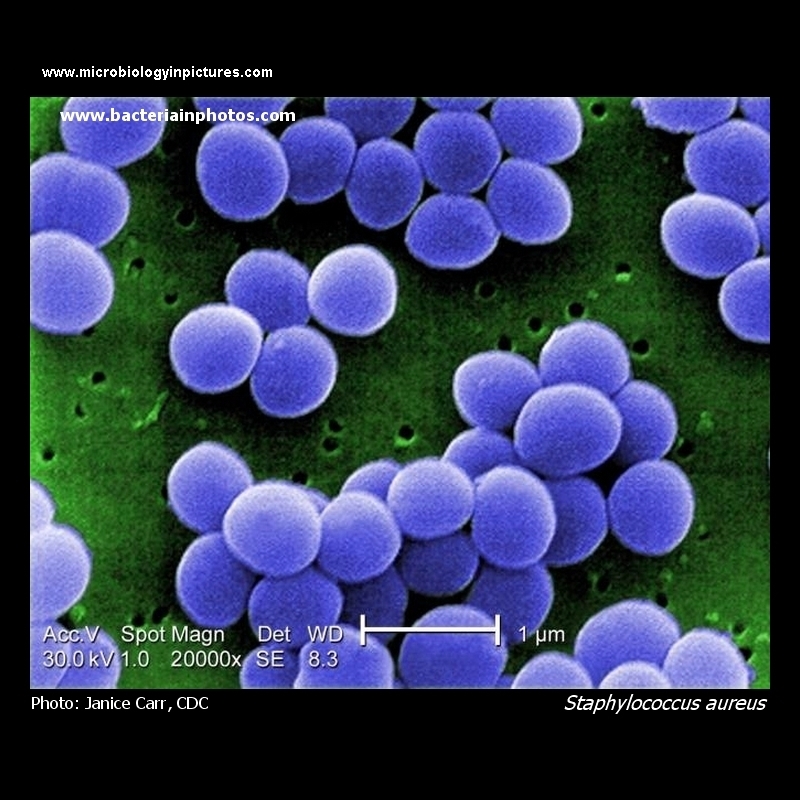 S. aureus electron microscopy (SEM)