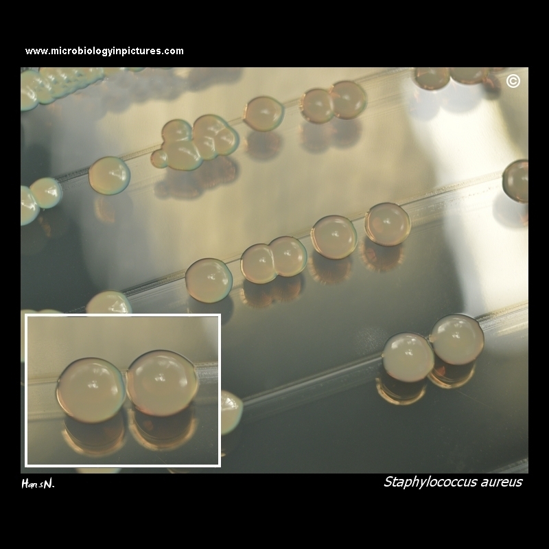 non-pigmented (white) colonies of Staphylococcus aureus