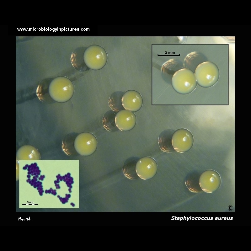 staphylococcus aureus