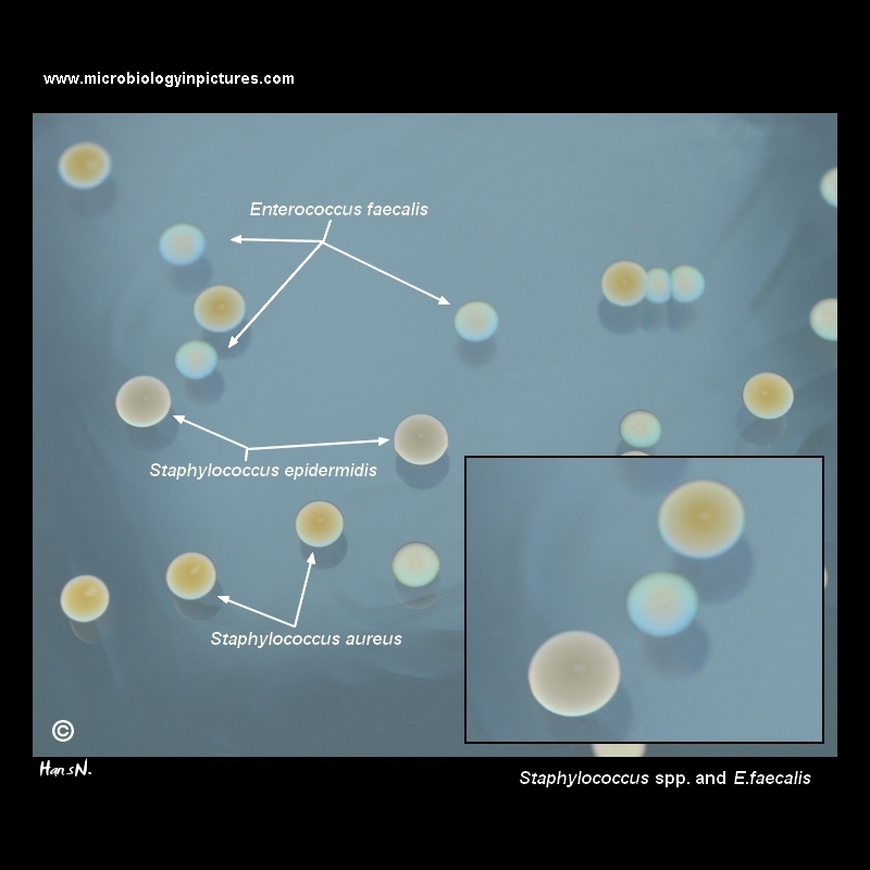 staphylococcus epidermidis,aureus and enterococcus colonies