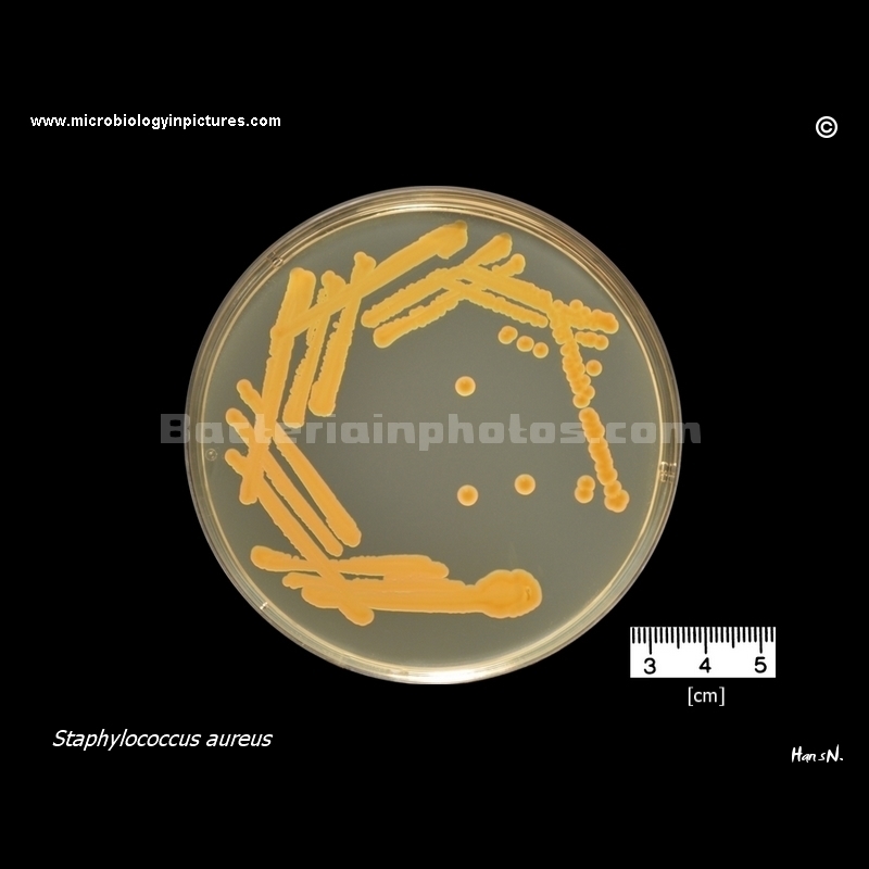 staphylococcus on brain heart infusion agar