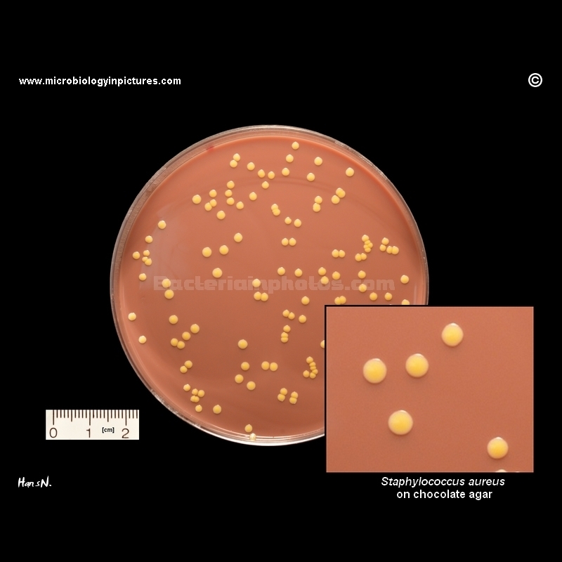 Growth of Staphylococcus aureus on Chocolate agar
