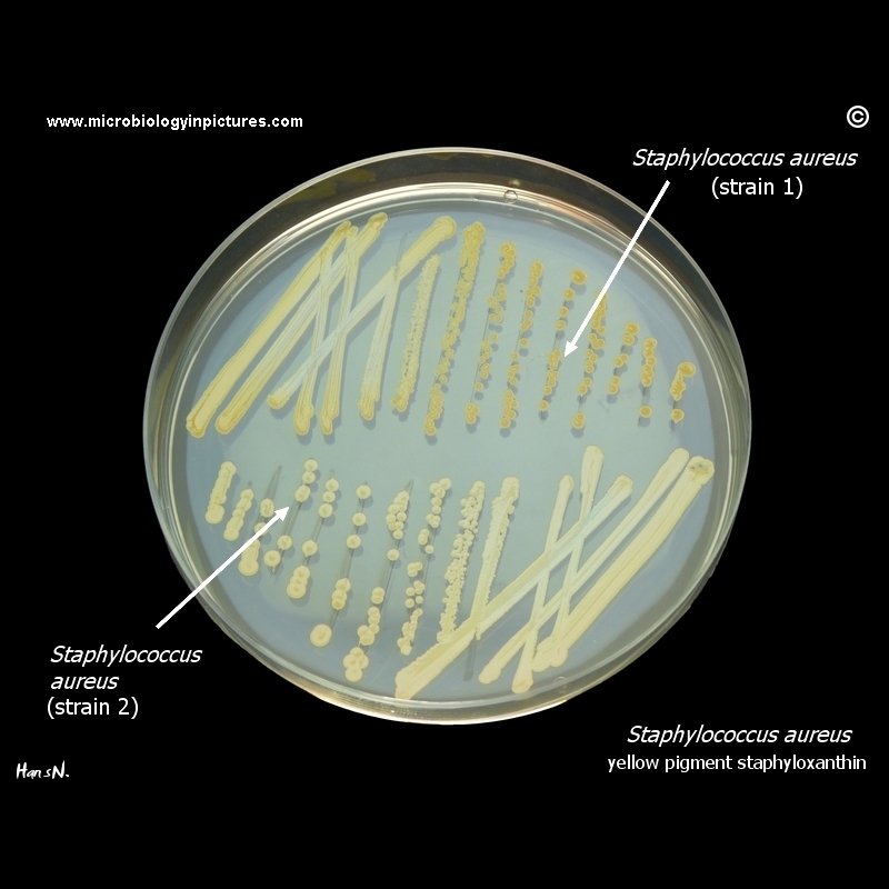 yellow and pale yellow staph aureus