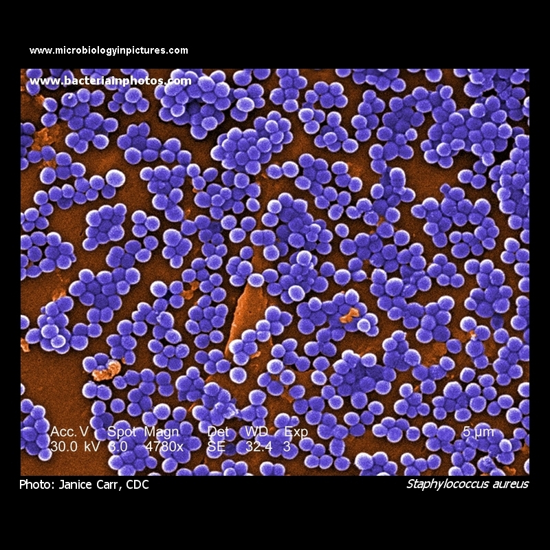 S. aureus electron microscopy (SEM)