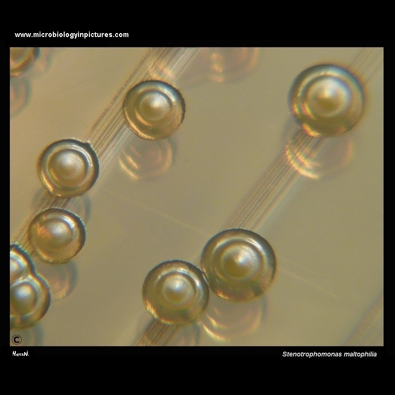 Stenotrophomonas maltophilia colonies on Mueller-Hinton agar