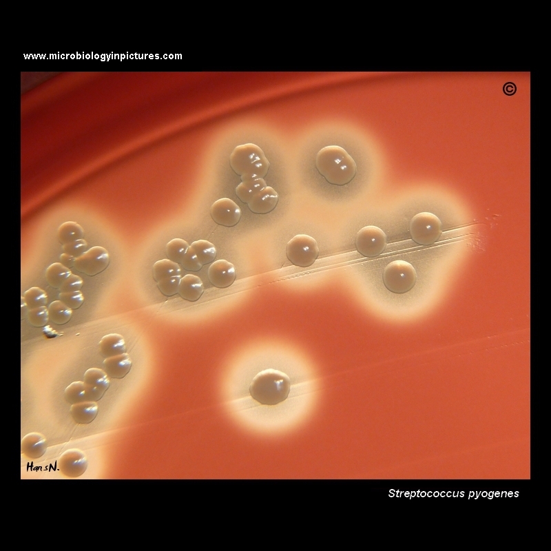 Streptococcus pyogenes beta-hemolytic colonies
