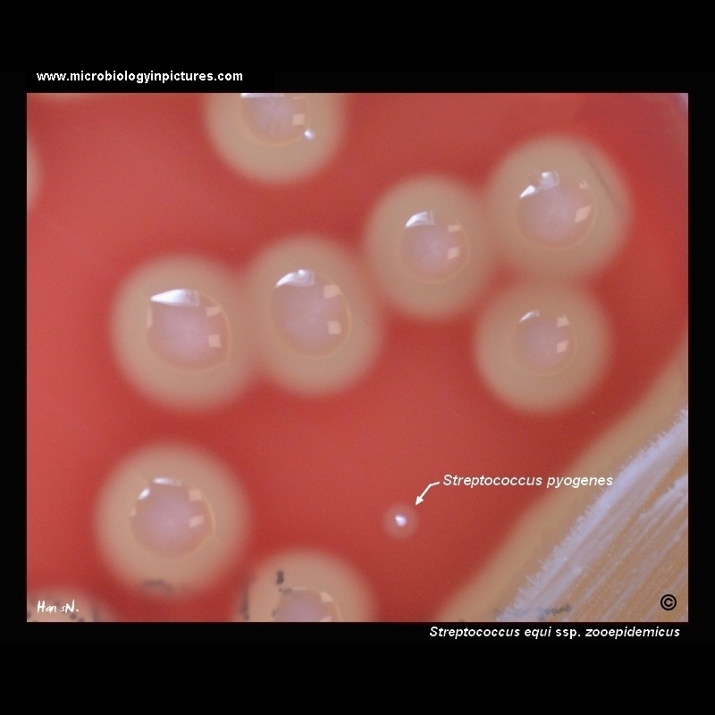 streptococcus equi zooepidemicus on blood agar plate
