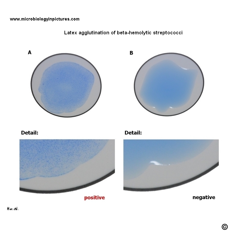 latex aglutination of GAS